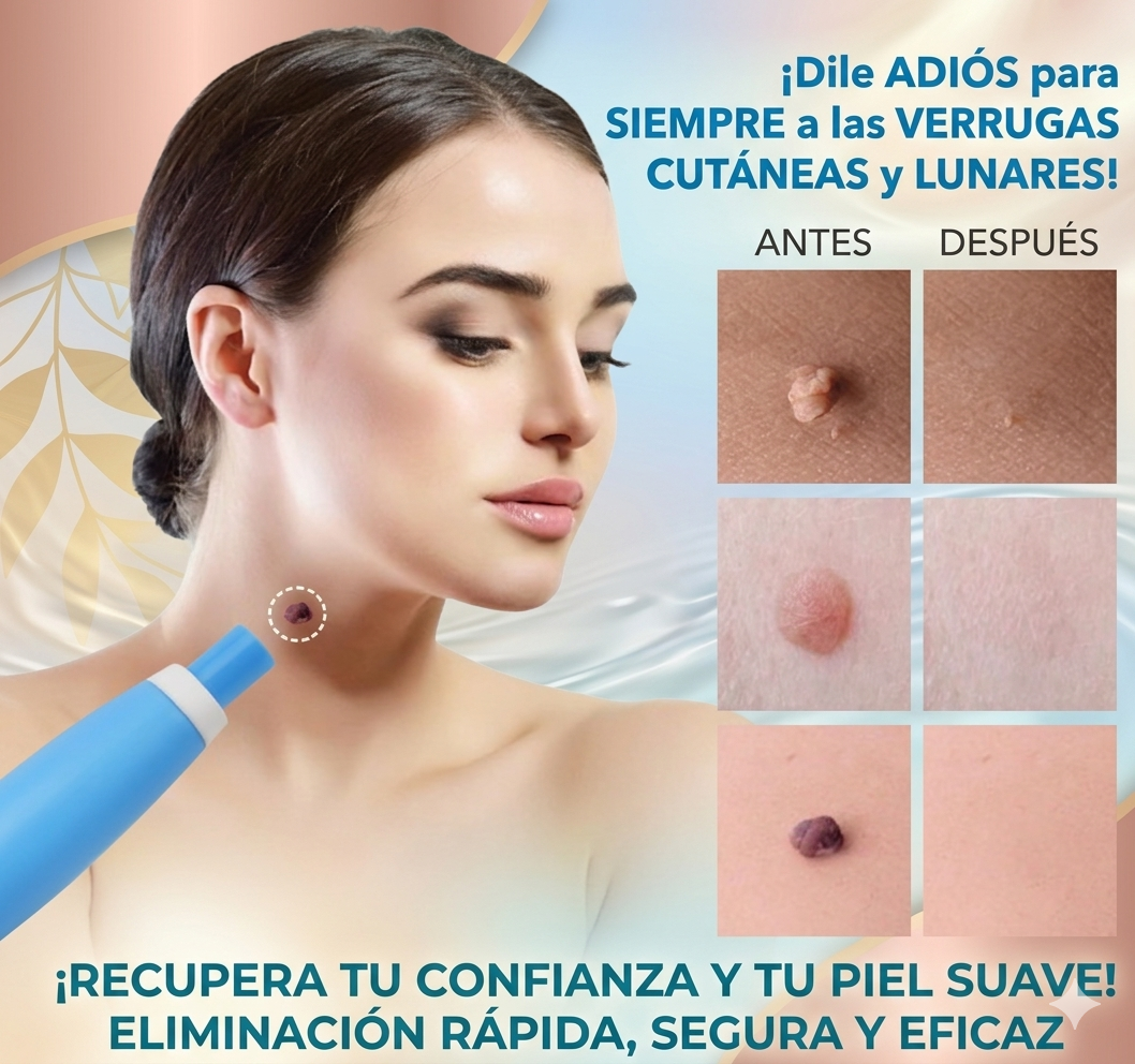 ✨ Kit Eliminador de Verrugas y Acrocordones ✨